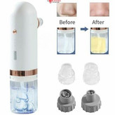 از بین بردن جای کک و مک با میکرودرم انزو EN-011