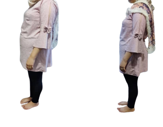 لاغری خیلی راحت و بدون رژیم با شکم بند لاغری ems